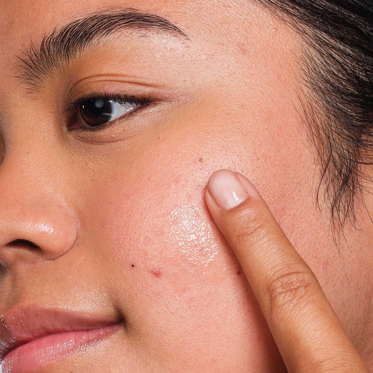 Dry & Dehydrated Skin